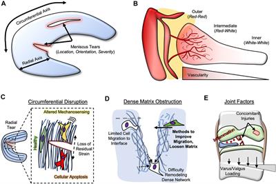 Impediments to Meniscal Repair: Factors at Play Beyond Vascularity